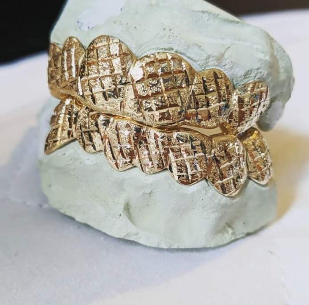 SOLID GOLD DIAMOND CUT WITH DIAMOND DUST GRILLZ [CUSTOM-FIT]