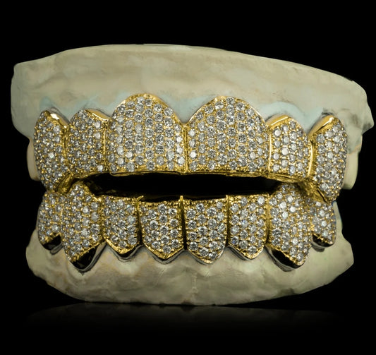 SOLID GOLD NATURAL DIAMOND ZIGZAG SETTING GRILLZ [CUSTOM-FIT]